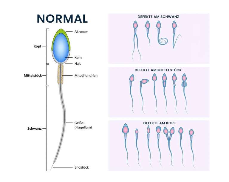 Gratis Spermiogramm Test im November